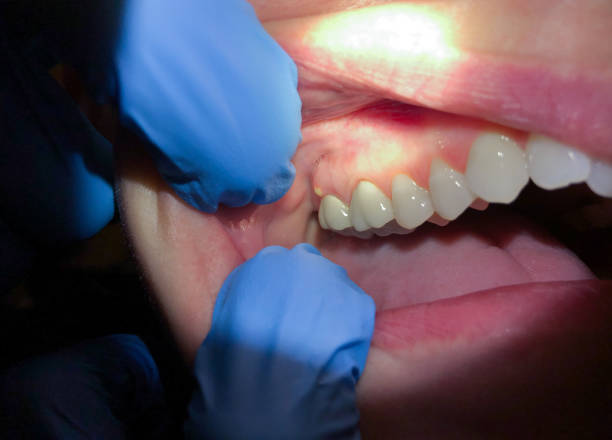 Best Walk-In Emergency Dentist in The Galena Territory, IL